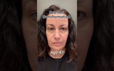 Facelift Naturally | Face Fitness | Face Yoga | Face Massage