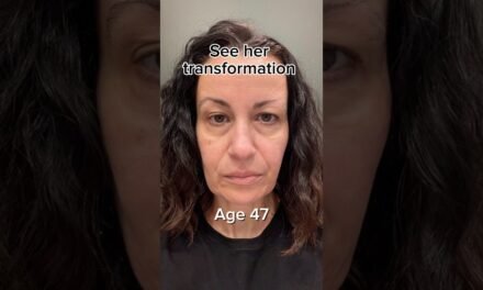 Facelift Naturally | Face Fitness | Face Yoga | Face Massage