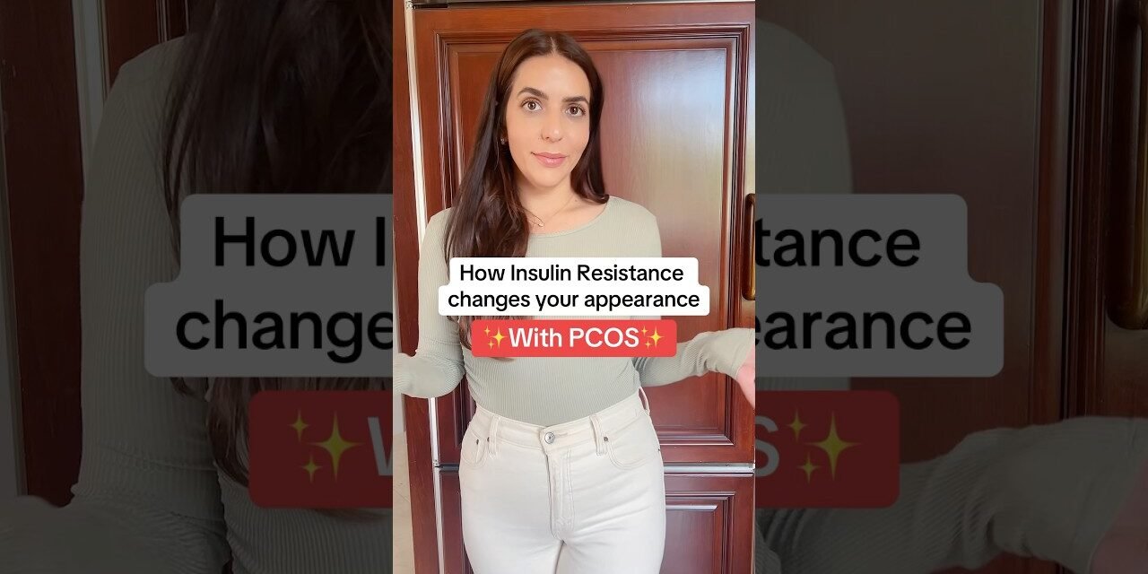 How Insulin Resistance changes your appearance with #pcos