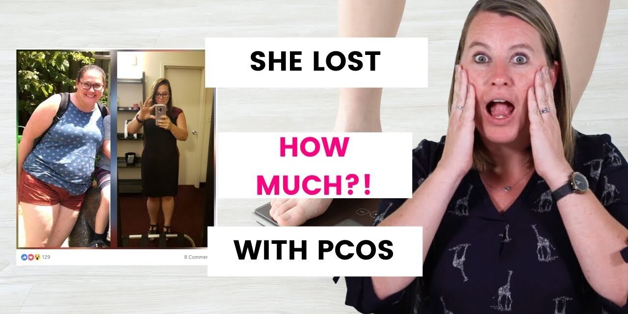 She lost 49lbs with PCOS – Weight Loss Success Story