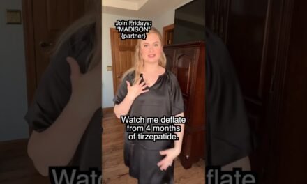 My Tirzepatide Before And After | Mounjaro, Zepbound Results